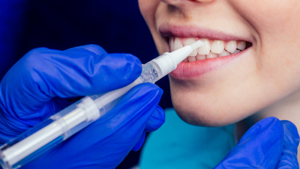 Snow Teeth Whitening