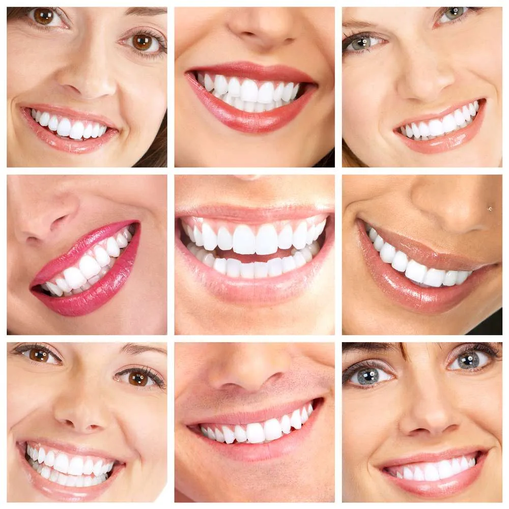 Women With White Teeth