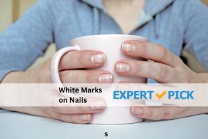 White Marks on Nails