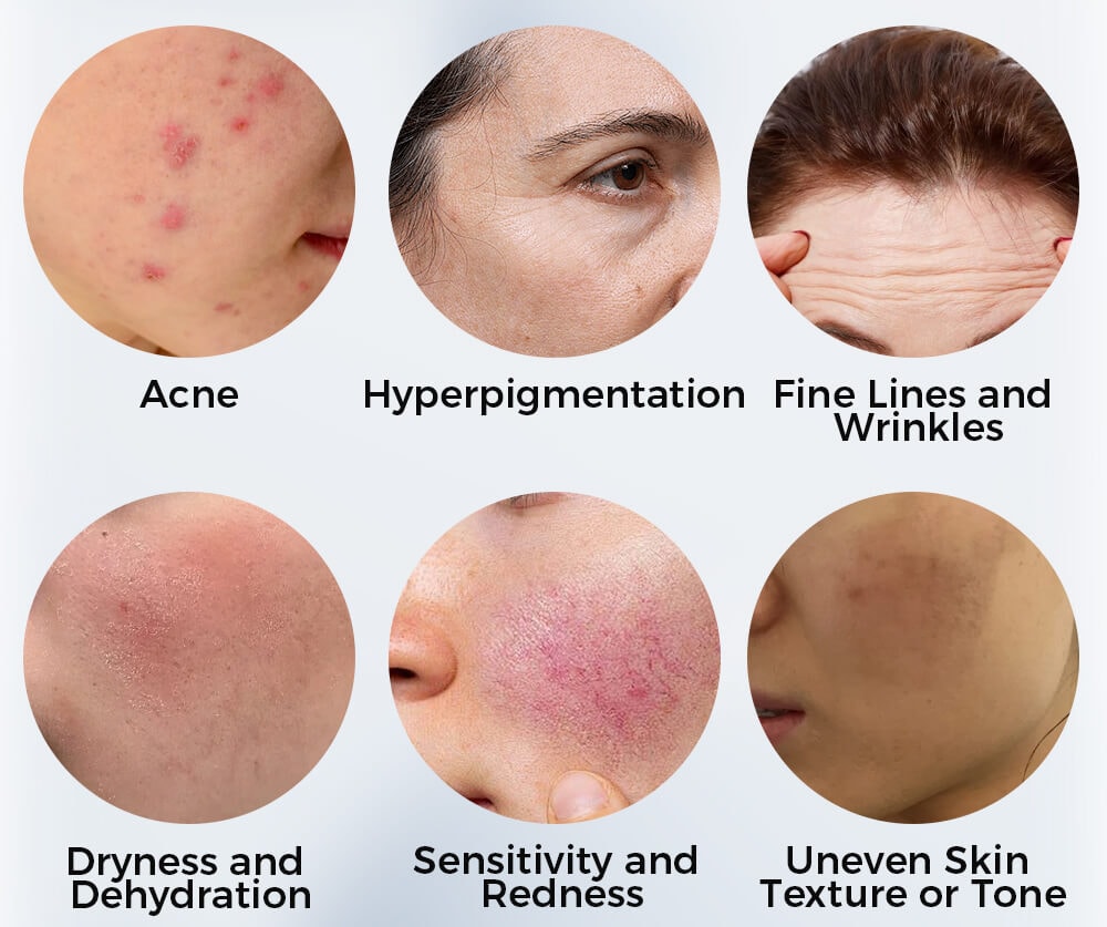 Skin Concerns